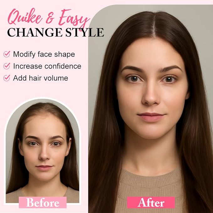 Hair Toppers for Women Real Human Hair Topper for Women with No Bangs Hairpieces Comfortable and Breathable 10 Inch Swiss Base 3D 360°Cover Glue-free and Shedding Free (Medium Brown)