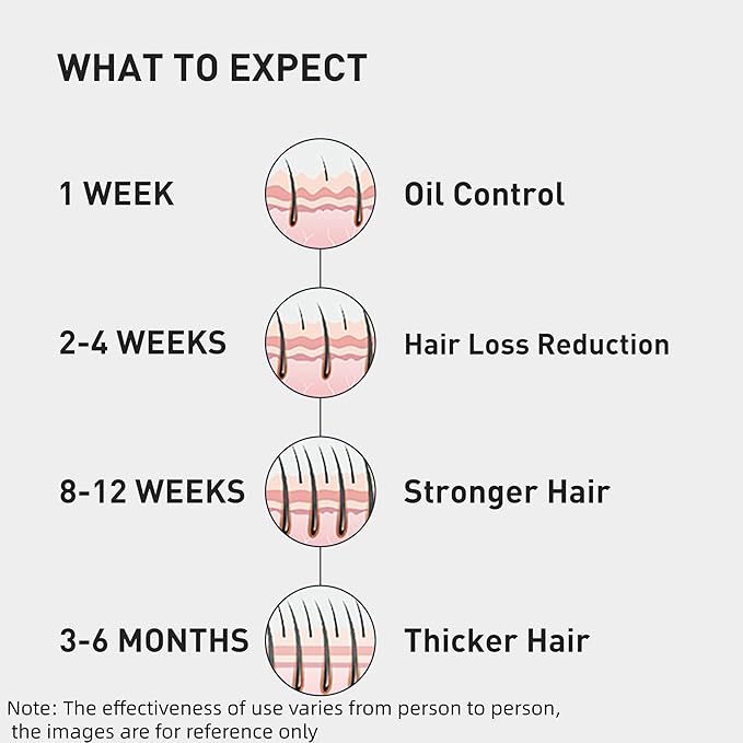 0.9% KX-826 KINTOR Hair Growth Spray,Strengthen Hair Nourish Hair follicles,Hair Care Products for Sparse Hair and Oily Hair Men&Women,360ml,Pro
