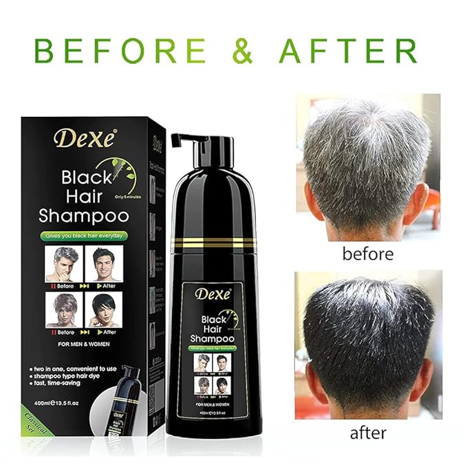 Dexe Hair Dye Shampoo 14.1 Fl Oz, Gray Hair Coverage, Black Hair Dye, Hair Color Shampoo, Black Hair Shampoo for Men & Women