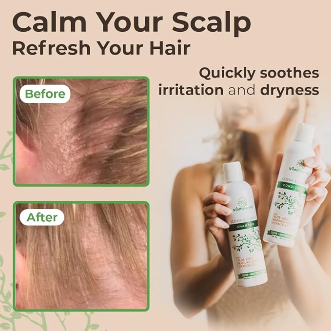 Eczema Psoriasis Anti-Dandruff & Seborrheic Dermatitis Shampoo Set for Dry, Itchy Scalp & Hair Treatment - For Men & Women