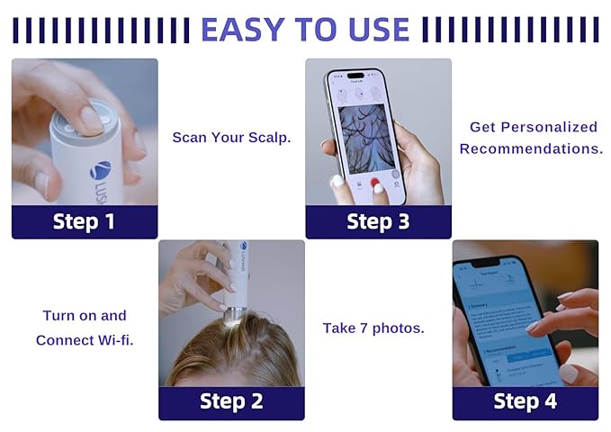 lushair Wireless Hair Analyzer, Hair Follicle Tester, Scalp Microscope, 16 Hair Tests, AI Smart Analysis Provides Care Plan