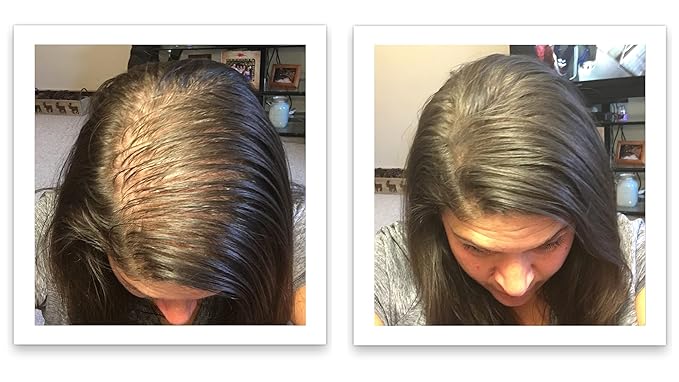 Hair Loss Concealer. Cover Bald Spot and Thinning Hair Instantly. Make Thin Hair Look 10X Fuller. All-Natural Hair Building Fiber. Trial Size (10-Day Supply). Dark Brown