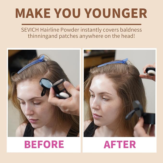 Sevich Hairline Powder,Instantly Conceals Hair Loss, Root Touch up Powder, Hair Shadow Toppers for Women & Men, Touch Up for Thinning Gray Hair, Windproof & Sweatproof,Black