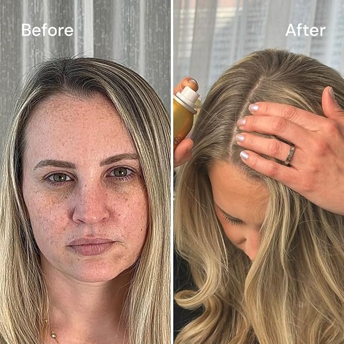 STYLE EDIT DARK BLONDE Root Concealer Touch Up Spray (Multiple Colors Available) Instantly Covers Greys And Dark Roots
