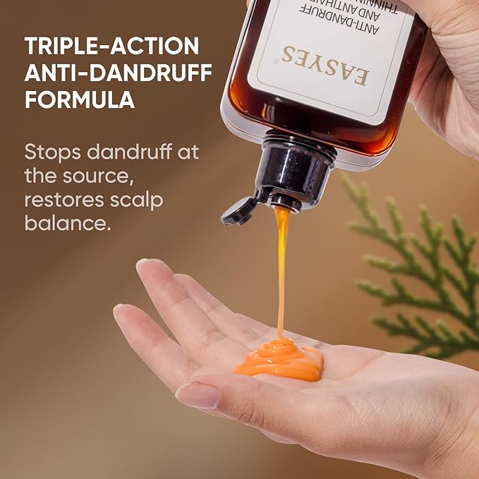 Anti Dandruff Shampoo with 1% Selenium Sulfide – Helps reduce Itchy Flaky Scalp, strengthens and nourishes hair, soothes the scalp, Controls Oil, 7oz