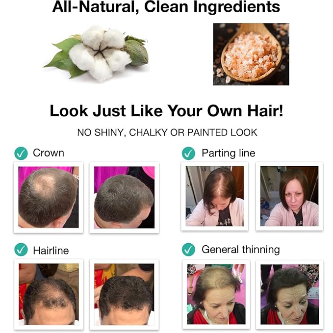 Cover Bald Spot and Thin Hair Instantly. Get 10X Fuller Hair With All-Natural, Plant-Based Hair Building Fiber (Trial Size, 10-Day Supply). Blonde