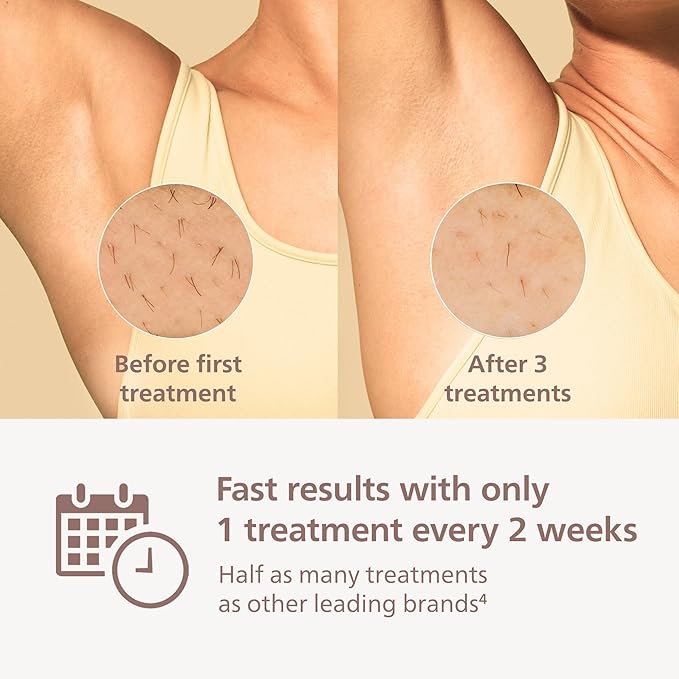 Philips Lumea 9000 Series IPL Hair Removal Device, Permanent Laser Hair Reduction for Women & Men, Easy & Comfortable Use at Home, SenseIQ, 4 Attachments for Body, Face, Bikini & Underarms, BRI984/03