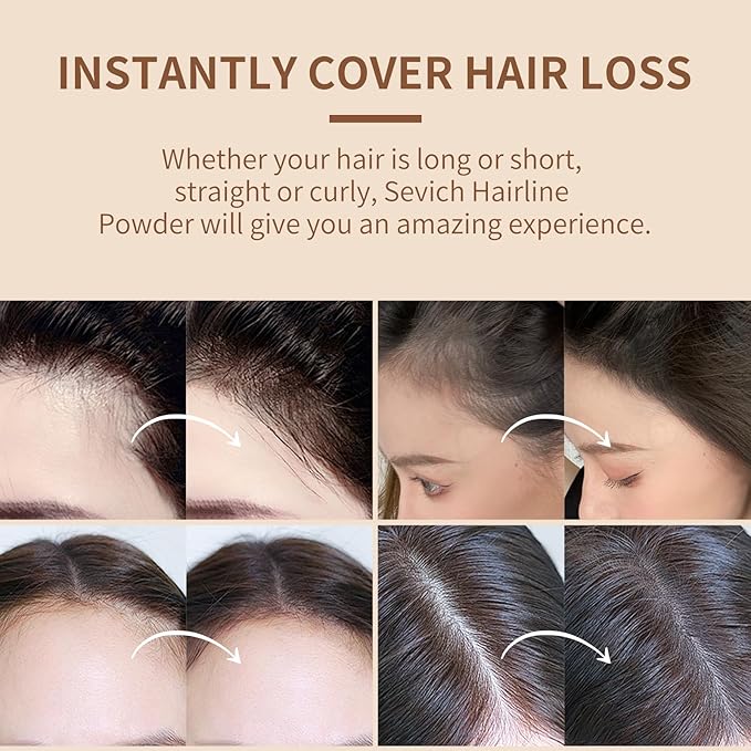Sevich Hairline Powder: Instantly Conceals Hair Loss and Gray Roots, Grey Windproof & Sweatproof Hair Toppers for Women & Men