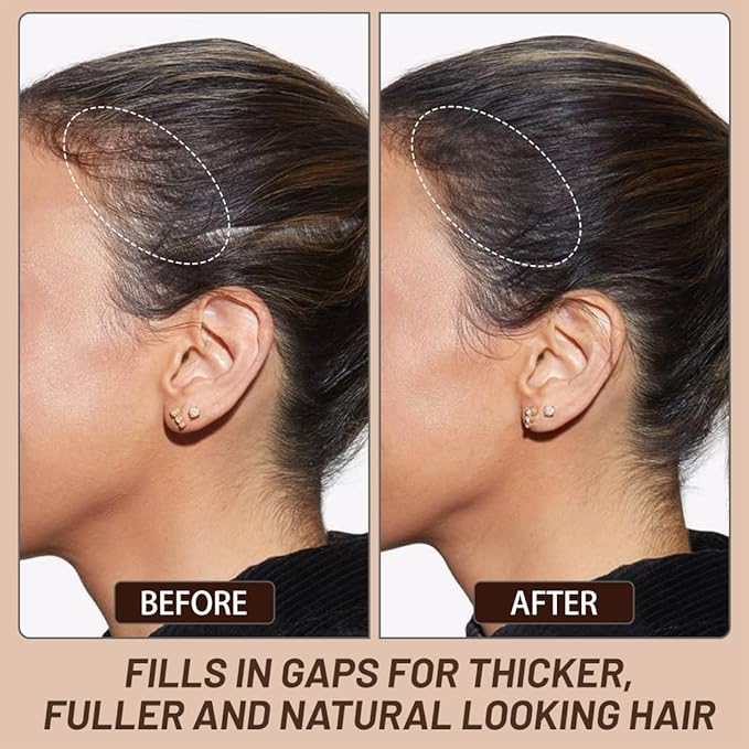 VOLLUCK Root Touch up Powder, Instant Hairline Powder for Thinning Areas and Gray Hair Coverage, Natural and Non-greasy Root Cover up for Women and Men (Dark Brown, 0.35 Ounce)