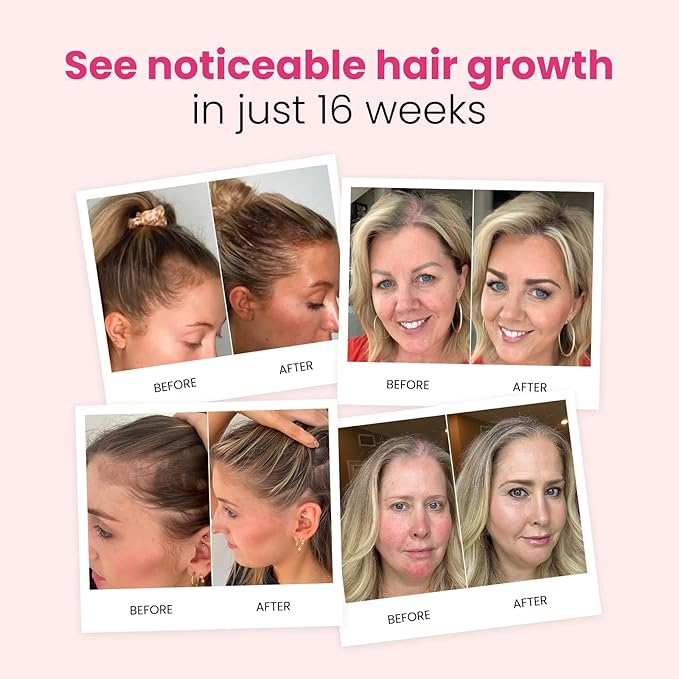 Trybello Hair Growth Shampoo | Natural Hair Thickening & Scalp Detox | Sulfate Free, Vegan, Anti-Hair Fall Formula | Caffeine, Aloe Vera, Turmeric, Urucum Extract | For All Hair Types