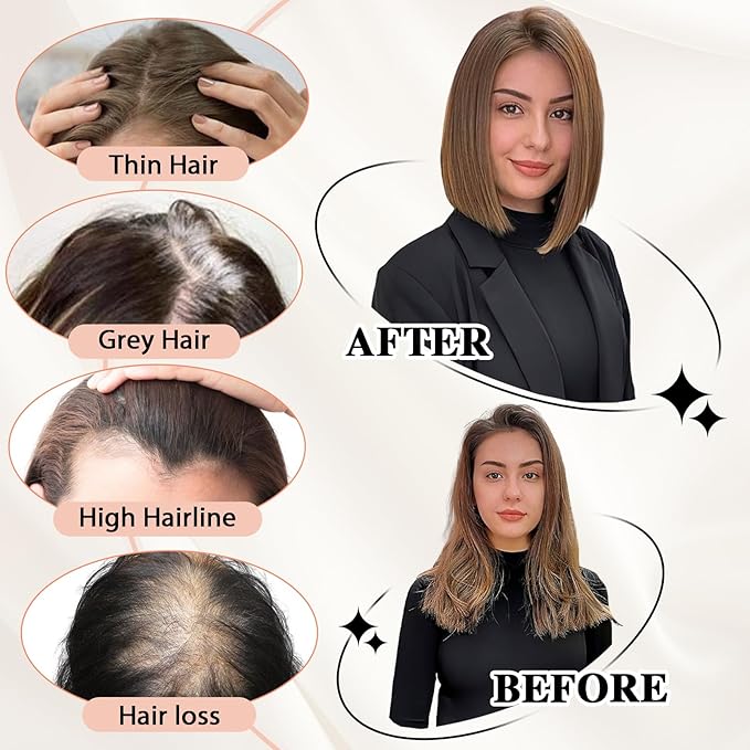 starluck Hair Toppers for Women with Bangs, 5"*5.5"Large Coverage Mixed Brown 100% Real Human Toppers for Women with Thinning Hair,Cover Gray Roots