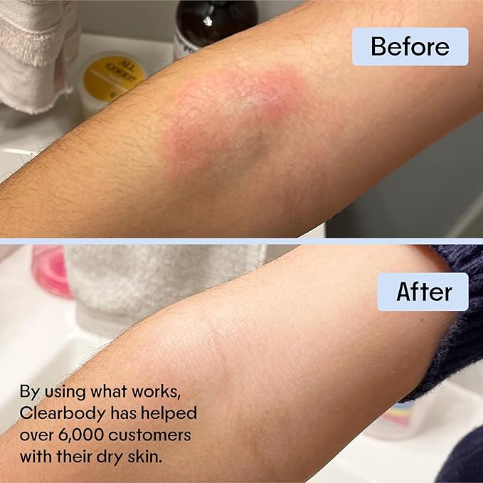 Clearbody Organics Manuka Honey Cream for Eczema & Dry Skin - Manuka Honey Ointment - Colloidal Oatmeal, Aloe & Natural Ingredients - Fast Relief Lotion for Reactive Skin - No Greasy Residue - 1 oz