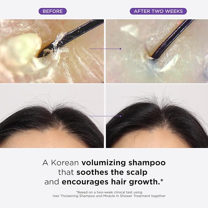 Dr. Groot Scalp Revitalizing Solution Travel Set for Hair Loss, Korean Hair Care, Hair Thickening Shampoo & Miracle in Shower Treatment, TSA Approved, 5 Seconds to Smooth Hair, Rosemary Oil