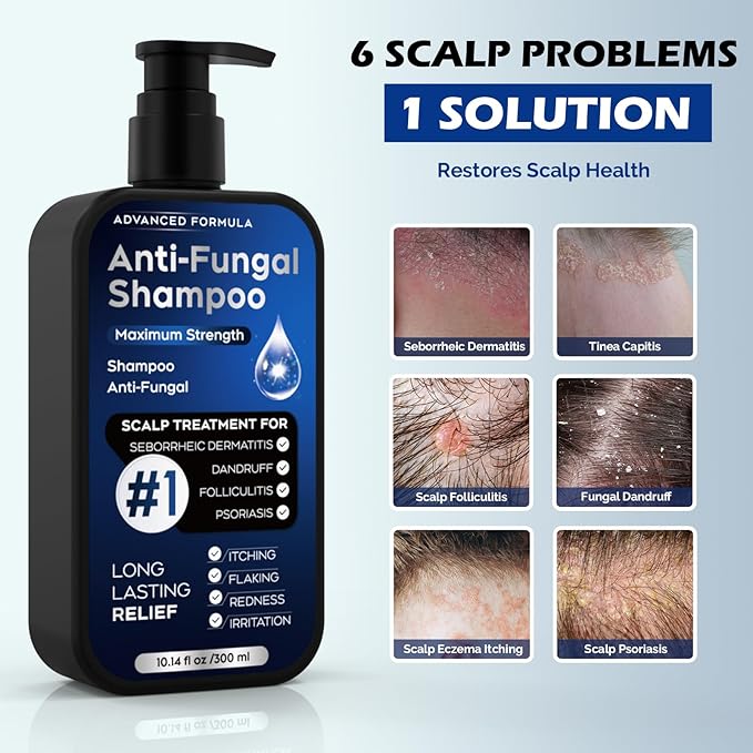 Antifungal Shampoo for Seborrheic Dermatitis, Folliculitis & Scalp Psoriasis, Anti-Dandruff Shampoo for Men & Women, Relieves Scalp Itching, Dryness, Sulfate & Paraben-Free, 10.1 Fl Oz-Fresh