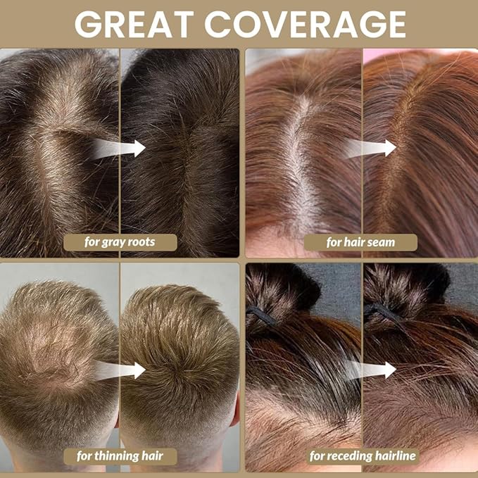 VOLLUCK Root Touch up Powder, Instant Hairline Powder for Thinning Areas and Gray Hair Coverage, Natural and Non-greasy Root Cover up for Women and Men (Dark Blonde, 0.14 Ounce)
