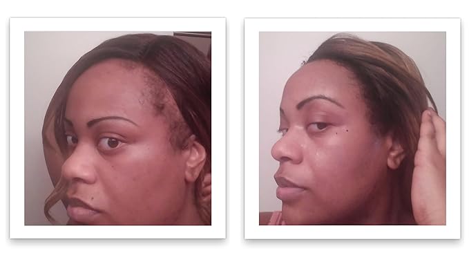 Caboki Root Touch Up Hair Volumizer: Fill in Hairline & Edges, Cover Thinning, Hair Loss, Bald Spots & Gray. TALC-Free, Healthful Men Women Light