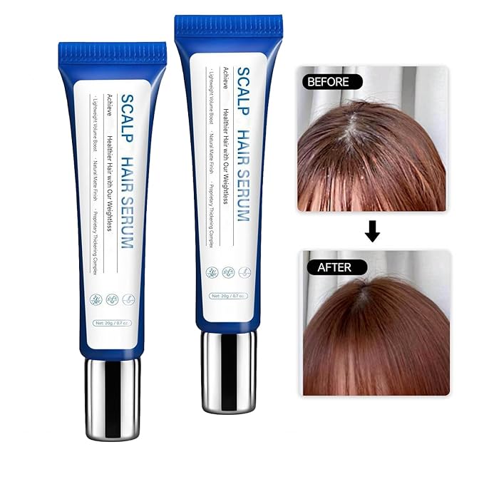 2PCS Scalp Care Serum for Men & Women, Gentle Exfoliation, Reduces Flakes, Soothes Itching, Non-Greasy Lightweight