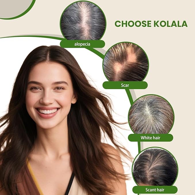 Hair Toppers for Women Real Human Hair 6x7 inch 150 Density Base 14 inch 65 grams ombre Ash Brown to Platinum Blonde for Women with Thinning Hair Cover Gray Roots（#8T60 14inch）