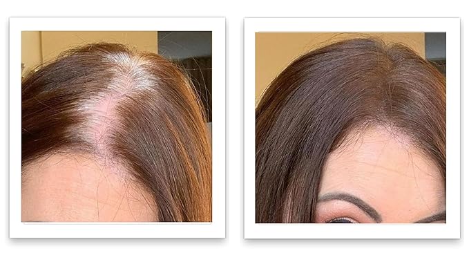 Caboki Hair Volumizer: Root Touch Up, Cover Thinning Hair, Bald Spots & Gray Roots, TALC-Free, For Men & Women, Medium Brown