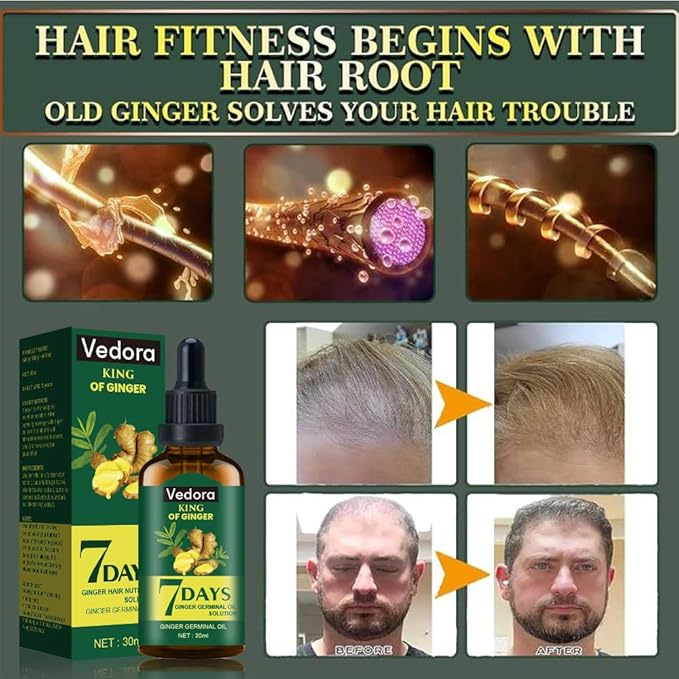 Vedora Ginger Oil for Hair Growth - Biotin Hair Growth Serum, 100% Pure Natural Ginger Essential Oil - Promotes Stronger, Thicker, Longer Hair in Women & Men - 1.05 Fl Oz / 30ML (1PC)