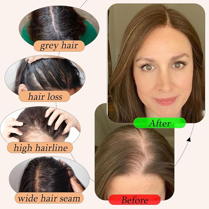 Human Hair Toppers for Women with Thinning Hair Real Human Topper Crown No Bangs 10 Inch #18P613 Ash Blonde mix Bleach Blonde