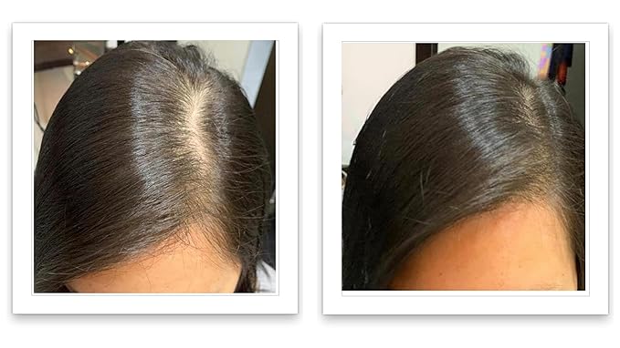 Caboki Hair Volumizer: Root Touch Up, Cover Thinning Hair, Bald Spots & Gray Roots, TALC-Free, For Men & Women, Medium Brown