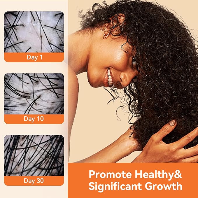 Batana Oil - Raw Batana Hair Mask Restores Damaged Thin Hair & Scalp, Organic Batana Oil Paste Conditioner for Hair Growth Suitable for Women & Men Prevents Loss Dry Fits All Hair Type (4oz)