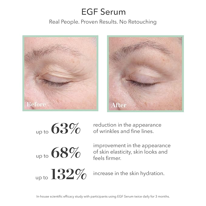 BIOEFFECT EGF Serum Treatment Duo with Hyaluronic Acid, Enhance Skin with Moisturizing, Firming, Wrinkle-Fighting Treatment for Face And Neck, Day And Night, Best Derma Roller Facial Serum