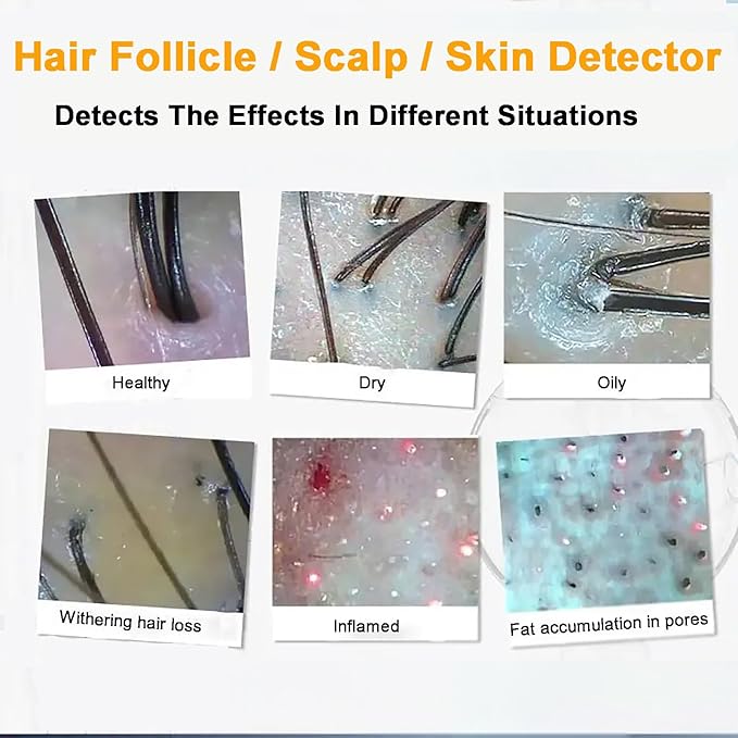 5 in 1 Scalp Skin Hair Follicle Scalp Detector, Multifunction Hair Care Machine Hair Analyzer, 70X 200X Lens Scalp Health Detection for Home Salon Beauty Salon