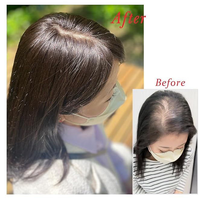 Real Human Hair Topper Pieces Double-Monofilament Top Hand-Tied Mid Length for Women Thinning BHADS914 (3 Natural Brown × Hair Length:9.8"(25cm), Base Size:3.5"×5.5"(9cm×14cm))
