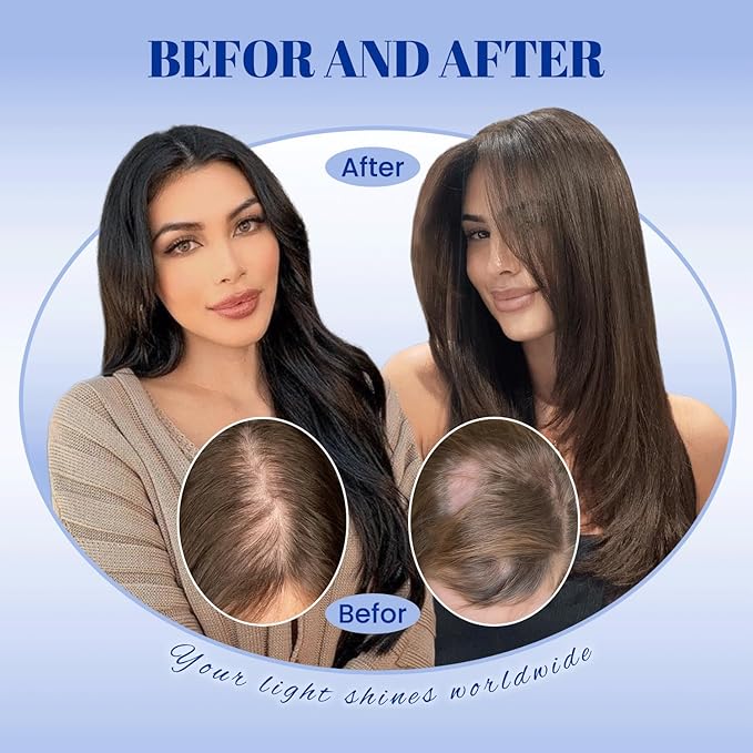 WORLDSTAR Hair Toppers for Women Real Human Hair No Bangs 6 * 7 Inch Base 16 Inch 75g #1 Jet Black 360°3D for Thinning 150% Density Hairpieces Long Coverage Wiglet for Daily Use (tp#1-16