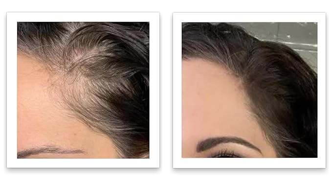 Caboki 10X Hair Powder for Thinning Hair, Light Brown - For Men & Women, TALC-Free, Healthful Formula, Instantly Fuller Hair, Flawless Roots, Rain and Sweat Resistant, Easy to Use