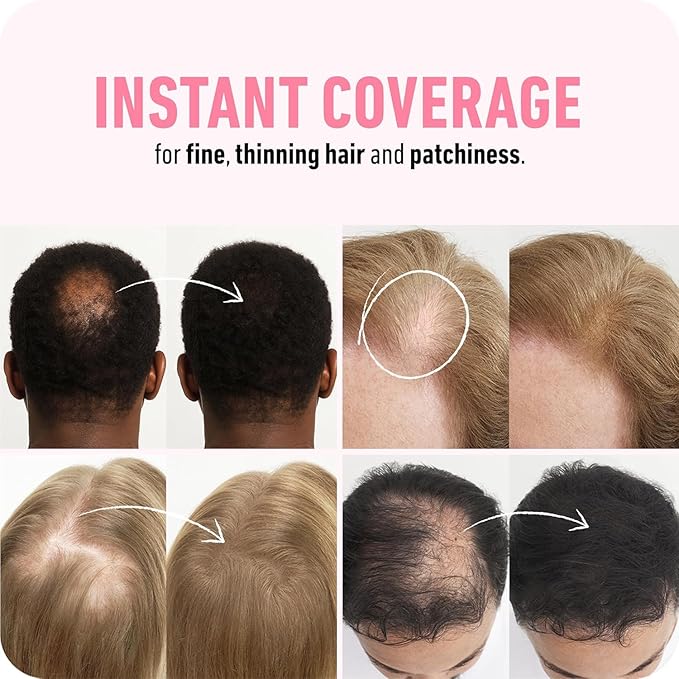 BOLDIFY Hair Fibers (28g) - Fill In Thinning and Fine Hair for an Instantly Fuller, Thicker Look - 14 Shades for Women & Men - Dark Auburn
