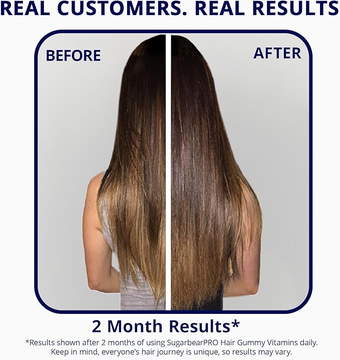 SugarBearPro Hair Vitamin Gummy 35 Day Supply, Extra Strength Biotin 6000mcg for Hair Growth, Vegan Vitamin B12, MSM, Inositol, Omega 3, Elderberry, Certified Kosher, Halal, Cruelty-Free
