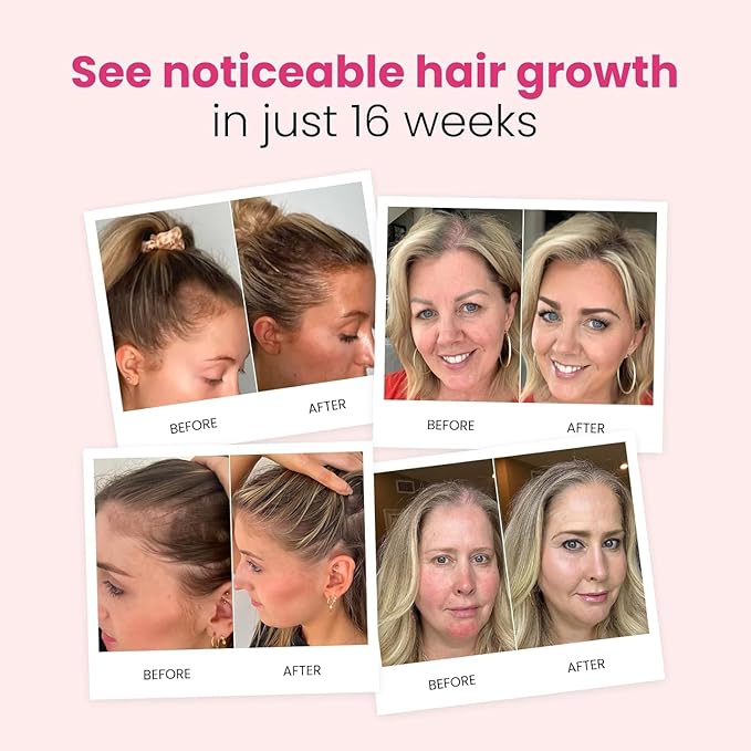 Trybello Hair Growth Shampoo | Natural Hair Thickening & Scalp Detox | Aloe Vera, Turmeric, and Urucum Extract | Sulfate-Free, Vegan, Anti-Hair Fall Formula | For Any Hair Type | 2 Pack Combo