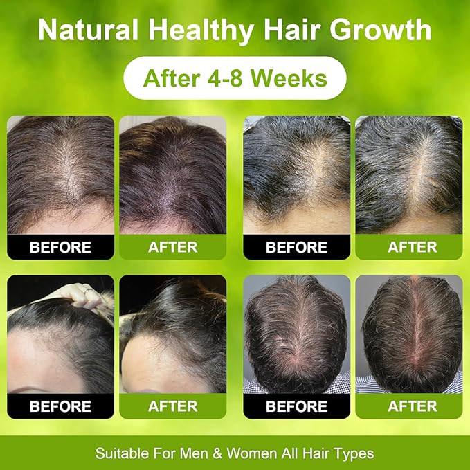 Dr. Sebi 100% RAW Batana Oil – Unrefined & Natural Batana Oil for Hair Growth, Boosts Thickness & Shine, Repairs Damage, Reduces Hair Loss, Fights Frizz & Split Ends For Men & Women 4.23 Fl Oz