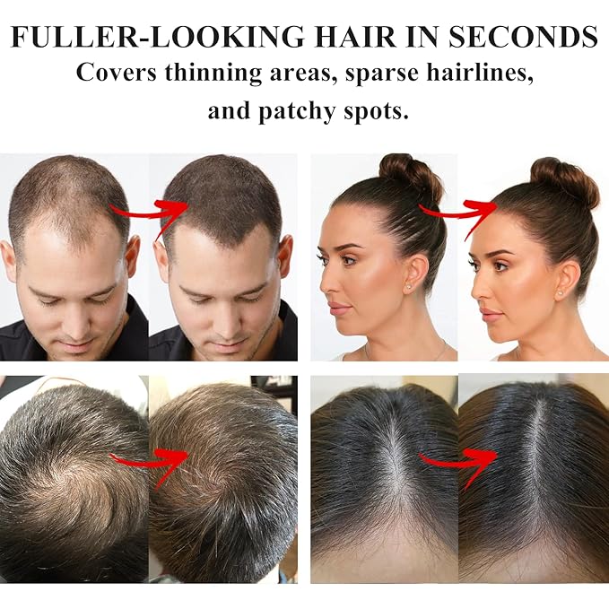 VOLLUCK Root Touch up Powder, Instant Hairline Powder for Thinning Areas and Gray Hair Coverage, Natural and Non-greasy Root Cover up for Women and Men (Light Blonde, 0.35 Ounce)