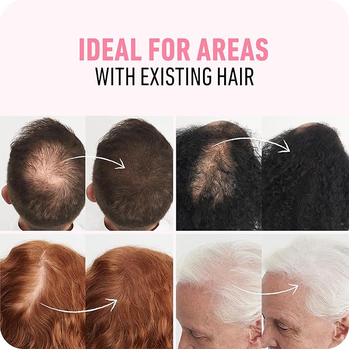 BOLDIFY Hair Fibers (56.5g) - Fill In Thinning and Fine Hair for an Instantly Fuller, Thicker Look - 14 Shades for Women & Men - Light Brown