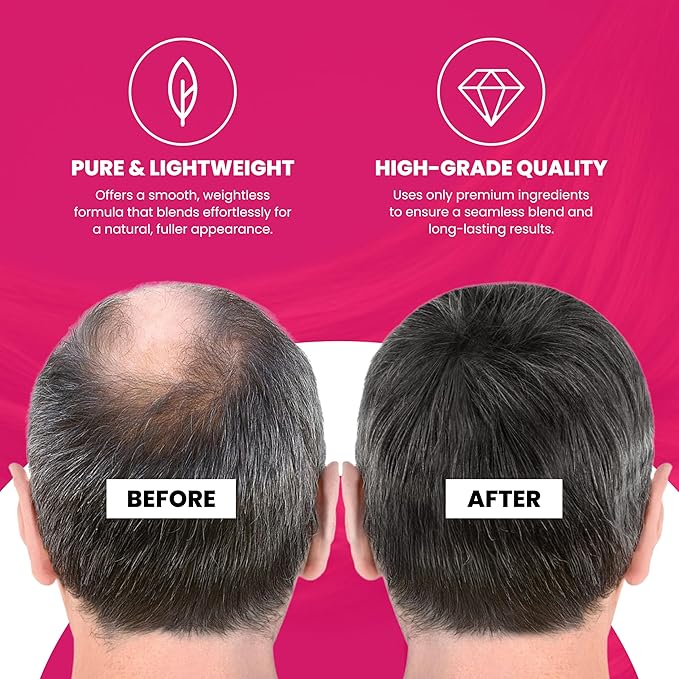 VELO Hairline Powder–BLACK Hair Root Touch Up Powder for Women & Men–Instantly Covers Gray Hair, Thinning Hair & Bald Spots–Sweatproof Root Cover Up–Puff & Mirror Compact, 13 Shades