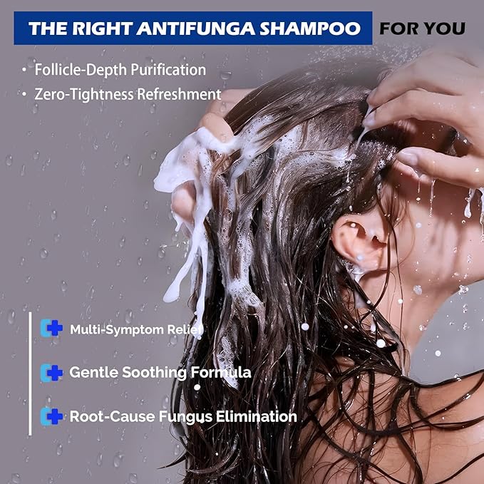Antifungal Shampoo for Seborrheic Dermatitis, Folliculitis & Scalp Psoriasis, Anti-Dandruff Shampoo for Men & Women, Relieves Scalp Itching, Dryness, Sulfate & Paraben-Free, 10.1 Fl Oz-Fresh