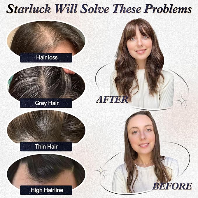 starluck Hair Toppers for Women Real Human Hair No Bangs, 100% Remy HumanHair Toppers for Women Hand-woven with Thinning,Cover Gray Roots,Adds Volume, Mixed Blonde And Brown