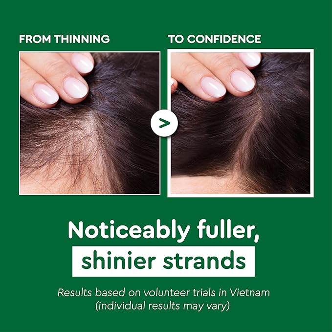 Vietnam's Touch | COCAY HOALA Polygonum Multiflorum 2in1 Herbal Shampoo – Strengthen Weak Roots, Reduce Hair Fall, Revive Lifeless Hair, Deeply Nourish & Soften – Paraben Free (14.8 oz)