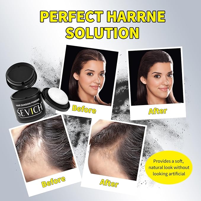 Sevich Hairline Powder 10g with Brush, Instantly Conceals Hair Loss & Thinning & Gray, 48H Waterproof Root Touch Up Powder, Natural Hair Shadow Toppers for Women & Men, 1 Box = 2.5 Boxes,Brown