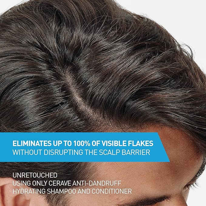 CeraVe Hydrating Anti Dandruff Conditioner, 0.5% Pyrithione Zinc Dandruff Treatment With Ceramides, Hyaluronic Acid & Niacinamide, Helps Eliminate Flakes & Reduce Itchy Scalp, Sulfate Free Conditioner
