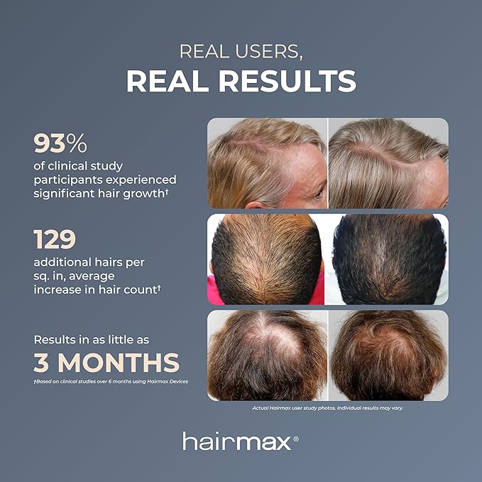Hairmax Ultima 12 LaserComb - (FDA Cleared) Laser Hair Regrowth Treatment Device for Men & Women - Reverses Thinning Hair Loss - Red Light Therapy to Stimulate Hair Growth - Cordless Design